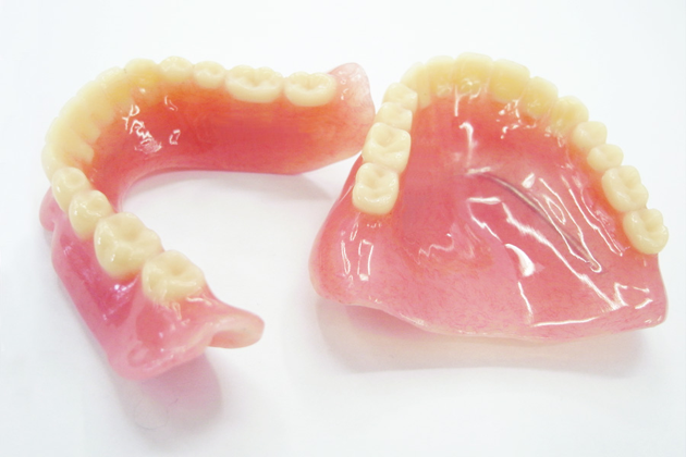 入れ歯（義歯）のイメージ